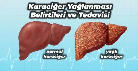 Başakşehir Aura Fitness karaciğer yağlanmasına iyi gelen egzersizler ve spor programı